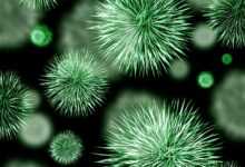 bacteria, pathogen, infection, green, germs, microbes, microscope, multi resistant, resistant, resistance, staphylococcus, staphylococci, viruses, bacterial species, toughness, medicine, biology, microbiology, micro recording, microphoto, creature, science, pest, greenish, bacteria, bacteria, bacteria, bacteria, bacteria, germs, viruses, biology, science, science